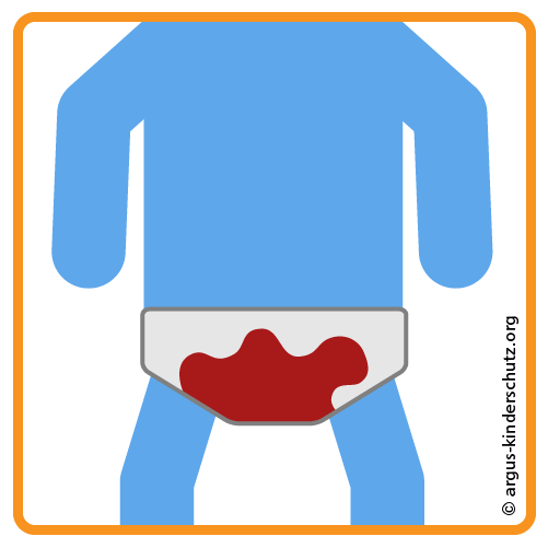 Icon Beschneidung Risiko Nachblutung